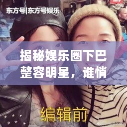 揭秘娛樂圈下巴整容明星，誰悄悄整過下巴？