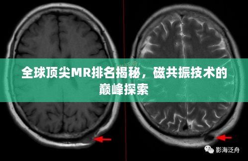 全球頂尖MR排名揭秘，磁共振技術(shù)的巔峰探索