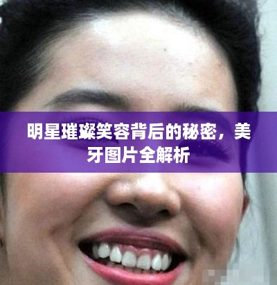 明星璀璨笑容背后的秘密，美牙圖片全解析