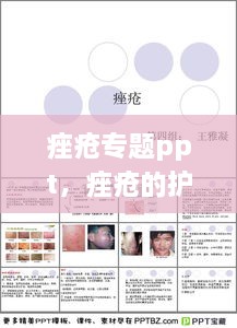 痤瘡專題ppt，痤瘡的護(hù)理ppt 