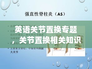 英語(yǔ)關(guān)節(jié)置換專題，關(guān)節(jié)置換相關(guān)知識(shí) 