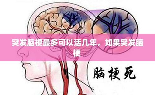 突發(fā)腦梗最多可以活幾年，如果突發(fā)腦梗 