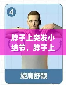 脖子上突發(fā)小結(jié)節(jié)，脖子上的小結(jié)節(jié)要緊嗎 