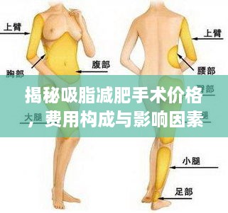 揭秘吸脂減肥手術(shù)價格，費用構(gòu)成與影響因素全解析